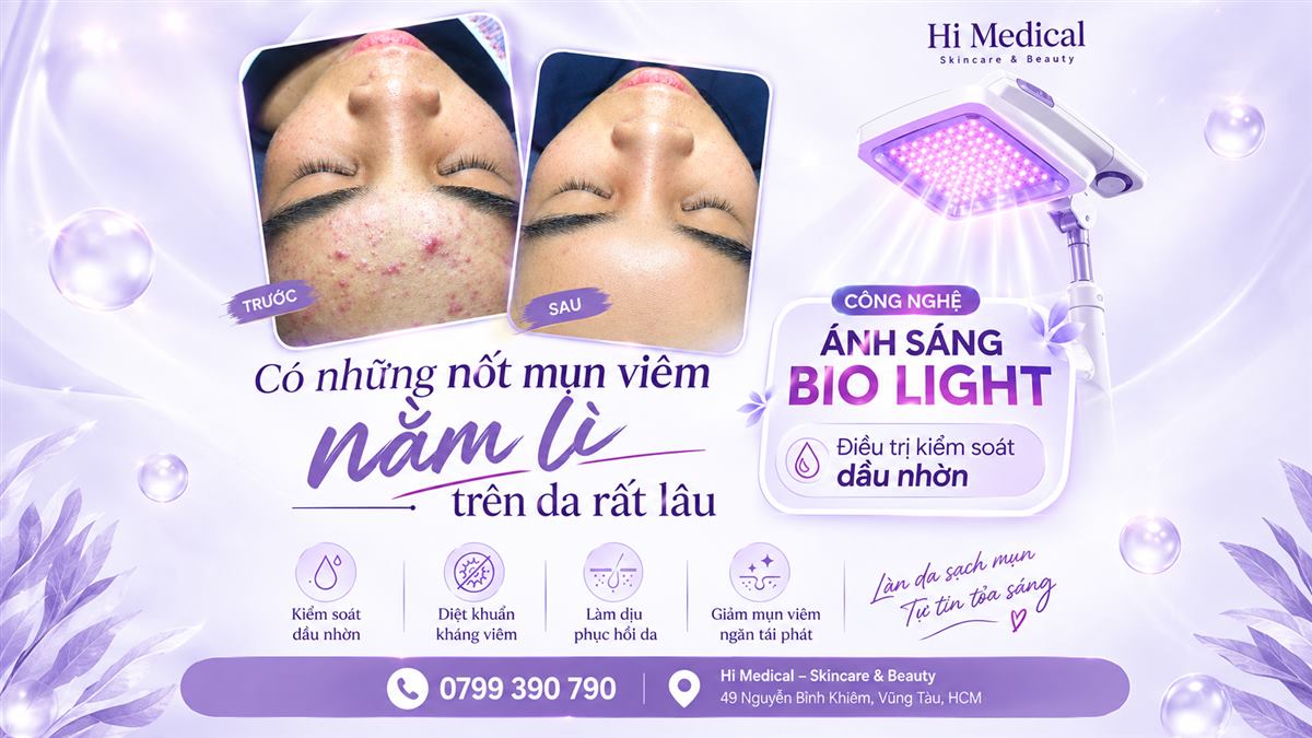 Chăm sóc da mụn ở tuổi dậy thì: 5 sai lầm khiến mụn "không bao giờ biến mất"